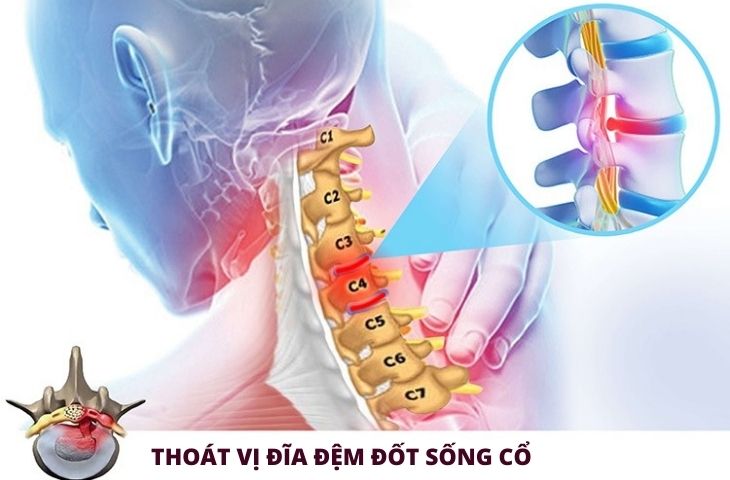 vật lý trị liệu